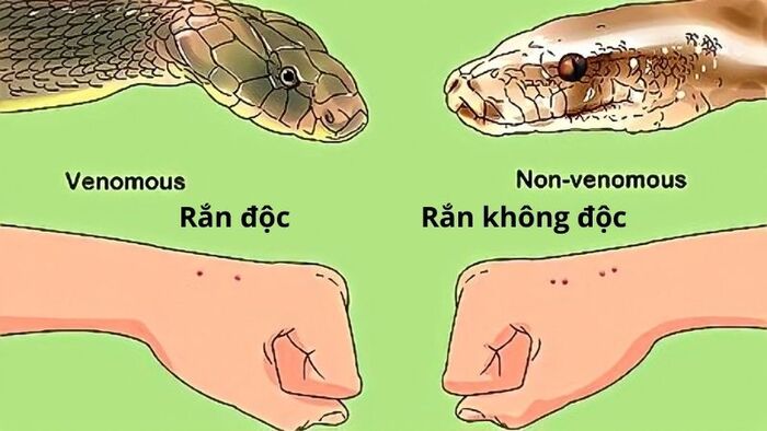 Dựa vào hình dáng vết cắn của rắn