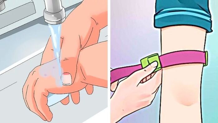 Cần làm gì khi bị rắn cắn?